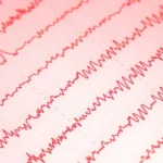 EEG (Elektroensefalografi) Nedir?
